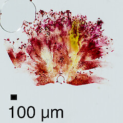 Leaf showing cells budding of to form propagules.<br>Photographer: Jeremy R. Rolfe, Date taken: 25/11/2013, Licence: <a target='_blank' href='https://creativecommons.org/licenses/by/4.0'>CC BY</a>. <a class='member-message' href='/nzpcn/why-join-nzpcn/' target='_blank'>Members can view a larger version of this image.</a>