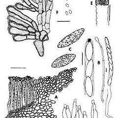 A. Section through apothecium showing margin and ectal excipulum.<br>Photographer: Manaaki Whenua Landcare Research, Licence: All rights reserved.