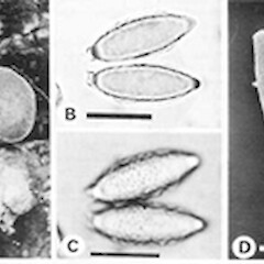 Hysterangium youngii