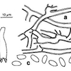 a. subicular hyphae, b. basidia,.<br>Photographer: Manaaki Whenua Landcare Research, Licence: All rights reserved.