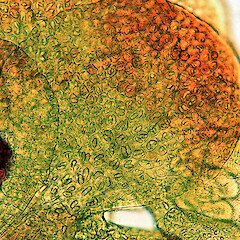 Oil bodies.<br>Photographer: Matt von Konrat, Licence: All rights reserved. <a class='member-message' href='/nzpcn/why-join-nzpcn/' target='_blank'>Members can view a larger version of this image.</a>