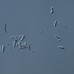 Spores.<br>Photographer: Marley Ford, Licence: <a target='_blank' href='https://creativecommons.org/licenses/by-nc/4.0'>CC BY-NC</a>. <a class='member-message' href='/nzpcn/why-join-nzpcn/' target='_blank'>Members can view a larger version of this image.</a>