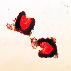 Zwackhia viridis - hymenial tissue, staining red following treatment with iodine (samples from P.J. de Lange CH3071, UNITEC 12163).<br>Photographer: Peter J de Lange, Date taken: 25/06/2020, Licence: <a target='_blank' href='https://creativecommons.org/licenses/by-nc/4.0'>CC BY-NC</a>. <a class='member-message' href='/nzpcn/why-join-nzpcn/' target='_blank'>Members can view a larger version of this image.</a>