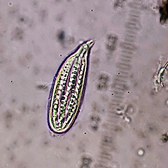 Zwackhia viridis - ascus (sample from P.J. de Lange CH3071, UNITEC 12163).<br>Photographer: Peter J de Lange, Date taken: 25/06/2020, Licence: <a target='_blank' href='https://creativecommons.org/licenses/by-nc/4.0'>CC BY-NC</a>. <a class='member-message' href='/nzpcn/why-join-nzpcn/' target='_blank'>Members can view a larger version of this image.</a>