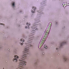 Zwackhia viridis - ascospore (sample from P.J. de Lange CH3071, UNITEC 12163).<br>Photographer: Peter J de Lange, Date taken: 25/06/2020, Licence: <a target='_blank' href='https://creativecommons.org/licenses/by-nc/4.0'>CC BY-NC</a>. <a class='member-message' href='/nzpcn/why-join-nzpcn/' target='_blank'>Members can view a larger version of this image.</a>
