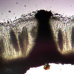Asci.<br>Photographer: Peter J de Lange, Licence: <a target='_blank' href='https://creativecommons.org/licenses/by-nc/4.0'>CC BY-NC</a>. <a class='member-message' href='/nzpcn/why-join-nzpcn/' target='_blank'>Members can view a larger version of this image.</a>