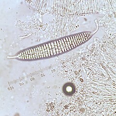 Ascospore.<br>Photographer: Peter J de Lange, Licence: <a target='_blank' href='https://creativecommons.org/licenses/by-nc/4.0'>CC BY-NC</a>. <a class='member-message' href='/nzpcn/why-join-nzpcn/' target='_blank'>Members can view a larger version of this image.</a>