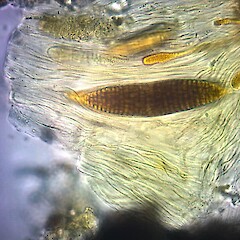 Ascospores.<br>Photographer: Andrew Marshall, Licence: All rights reserved. <a class='member-message' href='/nzpcn/why-join-nzpcn/' target='_blank'>Members can view a larger version of this image.</a>