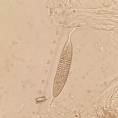 Ascospore.<br>Photographer: Andrew Marshall, Licence: All rights reserved. <a class='member-message' href='/nzpcn/why-join-nzpcn/' target='_blank'>Members can view a larger version of this image.</a>