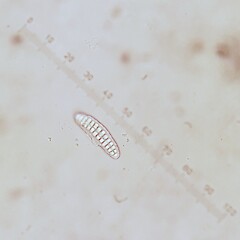 Ascospores.<br>Photographer: Andrew Marshall, Licence: <a target='_blank' href='https://creativecommons.org/licenses/by-nc/4.0'>CC BY-NC</a>. <a class='member-message' href='/nzpcn/why-join-nzpcn/' target='_blank'>Members can view a larger version of this image.</a>