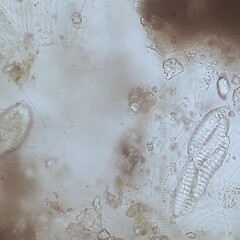 Asci and ascospores.<br>Photographer: Andrew Marshall, Licence: <a target='_blank' href='https://creativecommons.org/licenses/by-nc/4.0'>CC BY-NC</a>. <a class='member-message' href='/nzpcn/why-join-nzpcn/' target='_blank'>Members can view a larger version of this image.</a>