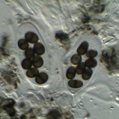 Asci with ascospores.<br>Photographer: Paul Cannon, Licence: <a target='_blank' href='https://creativecommons.org/licenses/by-nc/4.0'>CC BY-NC</a>. <a class='member-message' href='/nzpcn/why-join-nzpcn/' target='_blank'>Members can view a larger version of this image.</a>