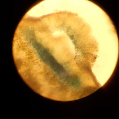 Blue iodine reaction.<br>Photographer: Melissa Hutchison, Date taken: 07/09/2020, Licence: <a target='_blank' href='https://creativecommons.org/licenses/by-nc/4.0'>CC BY-NC</a>. <a class='member-message' href='/nzpcn/why-join-nzpcn/' target='_blank'>Members can view a larger version of this image.</a>