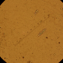 Ascospores.<br>Photographer: Melissa Hutchison, Date taken: 07/09/2020, Licence: <a target='_blank' href='https://creativecommons.org/licenses/by-nc/4.0'>CC BY-NC</a>. <a class='member-message' href='/nzpcn/why-join-nzpcn/' target='_blank'>Members can view a larger version of this image.</a>