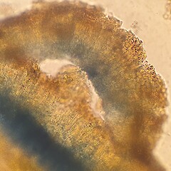 Blue iodine reaction.<br>Photographer: Andrew Marshall, Licence: <a target='_blank' href='https://creativecommons.org/licenses/by-nc/4.0'>CC BY-NC</a>. <a class='member-message' href='/nzpcn/why-join-nzpcn/' target='_blank'>Members can view a larger version of this image.</a>
