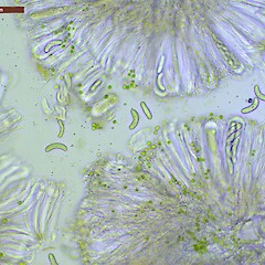 Asci and spores, Catlins Southland.<br>Photographer: Allison Knight, Licence: All rights reserved. <a class='member-message' href='/nzpcn/why-join-nzpcn/' target='_blank'>Members can view a larger version of this image.</a>