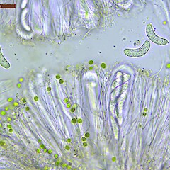 Asci and spores, Catlins Southland.<br>Photographer: Allison Knight, Licence: All rights reserved. <a class='member-message' href='/nzpcn/why-join-nzpcn/' target='_blank'>Members can view a larger version of this image.</a>
