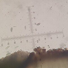 Ascospores.<br>Photographer: Andrew Marshall, Licence: <a target='_blank' href='https://creativecommons.org/licenses/by-nc/4.0'>CC BY-NC</a>. <a class='member-message' href='/nzpcn/why-join-nzpcn/' target='_blank'>Members can view a larger version of this image.</a>