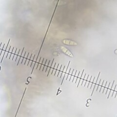 Clavate spores 12.5 x 7.5 microns.<br>Photographer: Marley Ford, Date taken: 28/03/2022, Licence: <a target='_blank' href='https://creativecommons.org/licenses/by-nc/4.0'>CC BY-NC</a>. <a class='member-message' href='/nzpcn/why-join-nzpcn/' target='_blank'>Members can view a larger version of this image.</a>