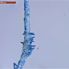 Soralia with larger isidiomorphs (stained).<br>Photographer: Jennifer bannister, Licence: <a target='_blank' href='https://creativecommons.org/licenses/by/4.0'>CC BY</a>. <a class='member-message' href='/nzpcn/why-join-nzpcn/' target='_blank'>Members can view a larger version of this image.</a>