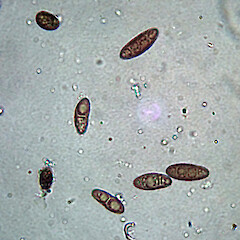Ascospores of Lithothelium australe. From herbarium specimen collected from Te Matarae Road, Rekohu (Chatham Island).<br>Photographer: Peter J de Lange, Date taken: 09/05/2022, Licence: <a target='_blank' href='https://creativecommons.org/licenses/by/4.0'>CC BY</a>. <a class='member-message' href='/nzpcn/why-join-nzpcn/' target='_blank'>Members can view a larger version of this image.</a>