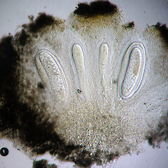 Apothecia section showing large ascospores filling the asci.<br>Photographer: Alan Fryday, Licence: <a target='_blank' href='https://creativecommons.org/licenses/by/4.0'>CC BY</a>. <a class='member-message' href='/nzpcn/why-join-nzpcn/' target='_blank'>Members can view a larger version of this image.</a>