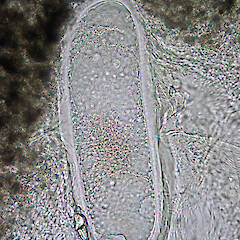 Ascospore.<br>Photographer: Alan Fryday, Licence: <a target='_blank' href='https://creativecommons.org/licenses/by/4.0'>CC BY</a>. <a class='member-message' href='/nzpcn/why-join-nzpcn/' target='_blank'>Members can view a larger version of this image.</a>