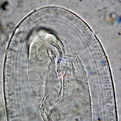 Part of ascospore showing striate wall. <br>Photographer: Alan Fryday, Date taken: 25/06/2022, Licence: <a target='_blank' href='https://creativecommons.org/licenses/by/4.0'>CC BY</a>. <a class='member-message' href='/nzpcn/why-join-nzpcn/' target='_blank'>Members can view a larger version of this image.</a>