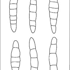 Ascospores. Scale = 10 micron.<br>Photographer: Alan Fryday, Licence: <a target='_blank' href='https://creativecommons.org/licenses/by/4.0'>CC BY</a>. <a class='member-message' href='/nzpcn/why-join-nzpcn/' target='_blank'>Members can view a larger version of this image.</a>