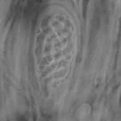 Asci, scale = 10 microns.<br>Photographer: Alan Fryday, Licence: <a target='_blank' href='https://creativecommons.org/licenses/by/4.0'>CC BY</a>. <a class='member-message' href='/nzpcn/why-join-nzpcn/' target='_blank'>Members can view a larger version of this image.</a>