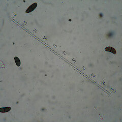 Spores.<br>Photographer: Allison Knight, Date taken: 17/07/2010, Licence: <a target='_blank' href='https://creativecommons.org/licenses/by/4.0'>CC BY</a>. <a class='member-message' href='/nzpcn/why-join-nzpcn/' target='_blank'>Members can view a larger version of this image.</a>