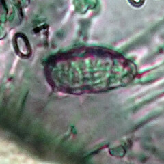 Ascospore - note thin wall, hyaline and muriform.<br>Photographer: Peter J de Lange, Date taken: 02/05/2023, Licence: <a target='_blank' href='https://creativecommons.org/licenses/by/4.0'>CC BY</a>. <a class='member-message' href='/nzpcn/why-join-nzpcn/' target='_blank'>Members can view a larger version of this image.</a>