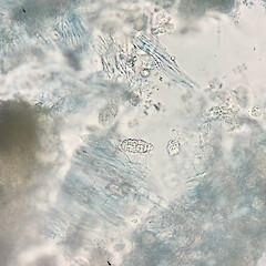 Ascospore - the muriform patterning, hyaline nature and thin-wall is evident in this image.<br>Photographer: Peter J de Lange, Date taken: 01/05/2023, Licence: <a target='_blank' href='https://creativecommons.org/licenses/by/4.0'>CC BY</a>. <a class='member-message' href='/nzpcn/why-join-nzpcn/' target='_blank'>Members can view a larger version of this image.</a>