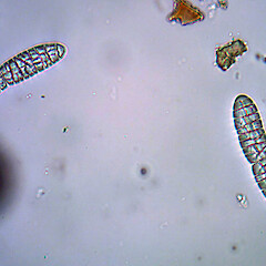 Ascospores of Bactrospora metabola.<br>Photographer: Andrew Marshall, Date taken: 12/04/2024, Licence: <a target='_blank' href='https://creativecommons.org/licenses/by/4.0'>CC BY</a>. <a class='member-message' href='/nzpcn/why-join-nzpcn/' target='_blank'>Members can view a larger version of this image.</a>