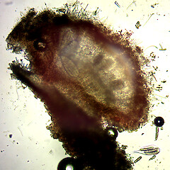 Apothecia (cross-section) of Bactrospora metabola.<br>Photographer: Andrew Marshall, Date taken: 12/04/2024, Licence: <a target='_blank' href='https://creativecommons.org/licenses/by/4.0'>CC BY</a>. <a class='member-message' href='/nzpcn/why-join-nzpcn/' target='_blank'>Members can view a larger version of this image.</a>