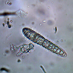 Ascospore of Bactrospora metabola.<br>Photographer: Andrew Marshall, Date taken: 12/04/2024, Licence: <a target='_blank' href='https://creativecommons.org/licenses/by/4.0'>CC BY</a>. <a class='member-message' href='/nzpcn/why-join-nzpcn/' target='_blank'>Members can view a larger version of this image.</a>