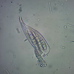 Ascus of Bactrospora metabola.<br>Photographer: Andrew Marshall, Date taken: 12/04/2024, Licence: <a target='_blank' href='https://creativecommons.org/licenses/by/4.0'>CC BY</a>. <a class='member-message' href='/nzpcn/why-join-nzpcn/' target='_blank'>Members can view a larger version of this image.</a>