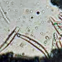Ascospores of Schismatomma neozelandicum from specimens collected from Chatham Islands, Rekohu (Chatham Island), Kaingaroa, Kaingaroa Point in May 2024 (image: Campbell James).<br>Photographer: Peter J de Lange, Date taken: 10/05/2024, Licence: <a target='_blank' href='https://creativecommons.org/licenses/by/4.0'>CC BY</a>.