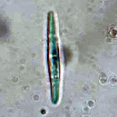 Ascospores of Schismatomma neozelandicum from specimens collected from Chatham Islands, Rekohu (Chatham Island), Kaingaroa, Kaingaroa Point in May 2024 (image: Campbell James).<br>Photographer: Peter J de Lange, Date taken: 10/05/2024, Licence: <a target='_blank' href='https://creativecommons.org/licenses/by/4.0'>CC BY</a>. <a class='member-message' href='/nzpcn/why-join-nzpcn/' target='_blank'>Members can view a larger version of this image.</a>